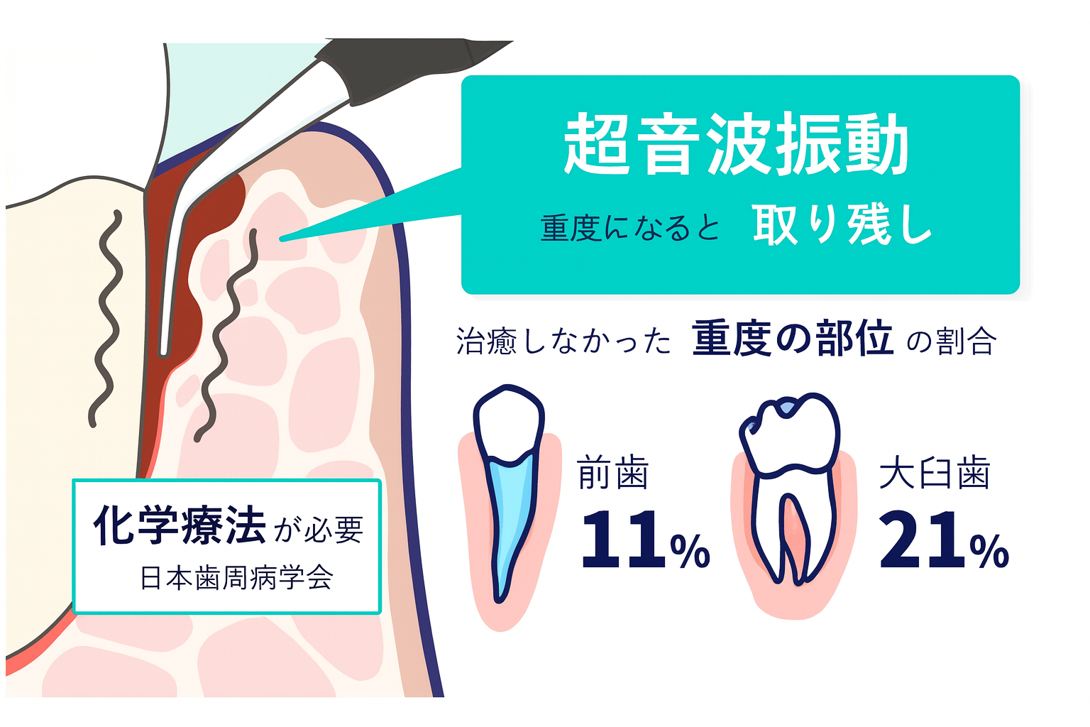 従来の治療のイメージ